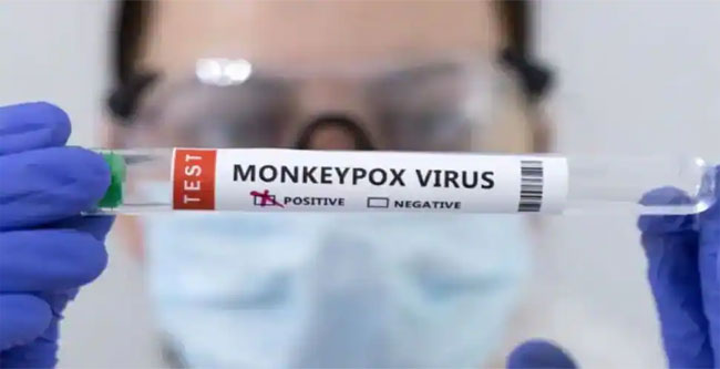 అర్జెంటీనాలోనూ Monkeypox virus కలకలం