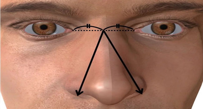 Penis size: ముక్కు సైజును బట్టే పురుషాంగ పరిమాణం..సంచలనం రేపుతున్న కొత్త అధ్యయనం