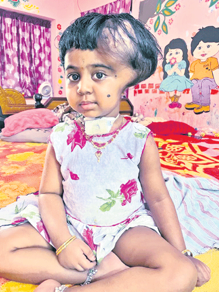 చిన్నారి జోషిక మృతి