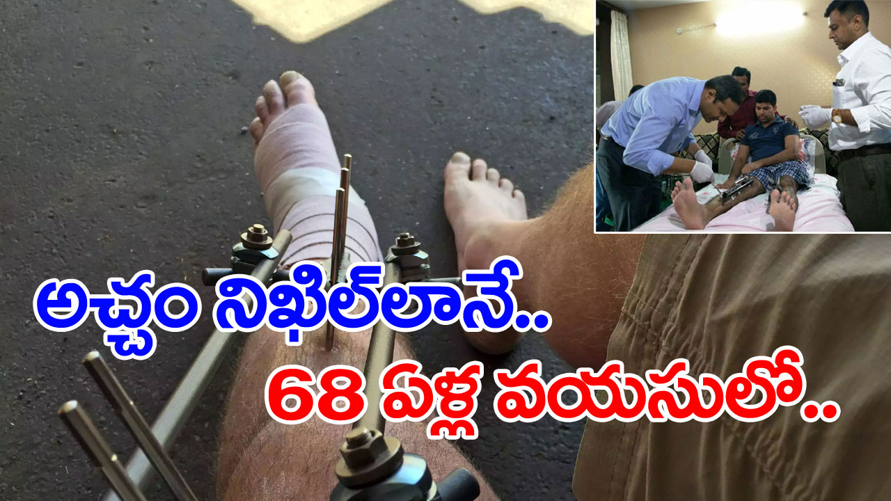 Leg Lengthening Surgery 1 2 leg-lengthening-surgery-1-2