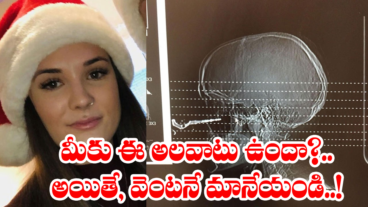 Viral News: కారు తాళం ఎంత పని చేసిందో.. ఆ చిన్న 'కీ' వల్ల ఓ యువతికి జరిగిన ప్రమాదం చూసి వైద్యులే హడలెత్తిపోయారు..! 