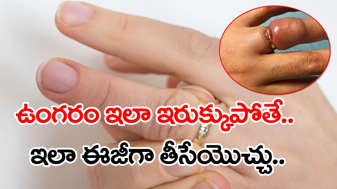 Viral Video: వారెవ్వా.. ఏం టెక్నిక్ బాసూ.. చేతివేలికి పెట్టిన రింగు.. ఇలా ఇరుక్కుపోతే.. నొప్పి లేకుండా ఎంత ఈజీగా తీశాడో మీరే చూడండి..!