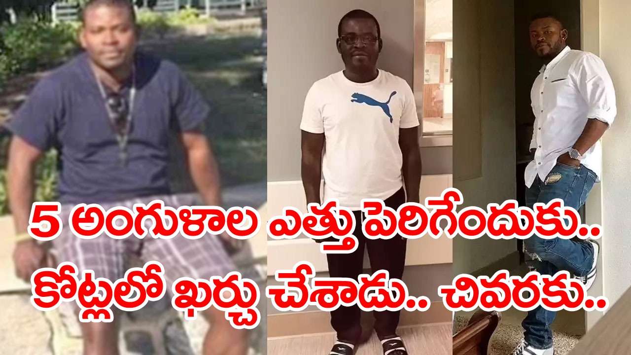 Height Increase Surgery: పొట్టిగా ఉంటే ఎవరూ ప్రేమించడం లేదట.. ఎత్తు పెరిగేందుకు రూ.1.35 కోట్లతో సర్జరీ.. ఇప్పుడు ఎలా ఉన్నాడంటే..!