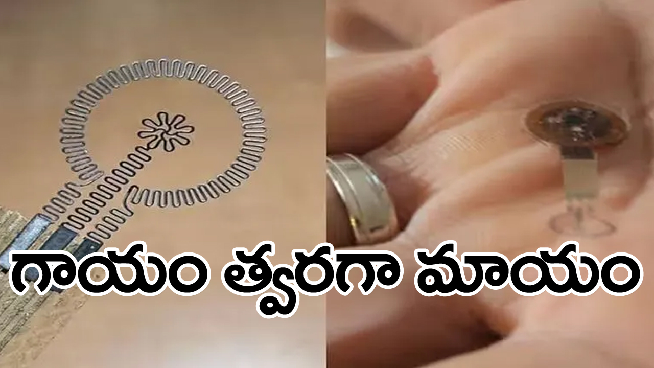 electronic bandage: గాయాలను వేగంగా మాయం చేసే వినూత్న బ్యాండ్ ఎయిడ్... ఎలా పనిచేస్తుందంటే...