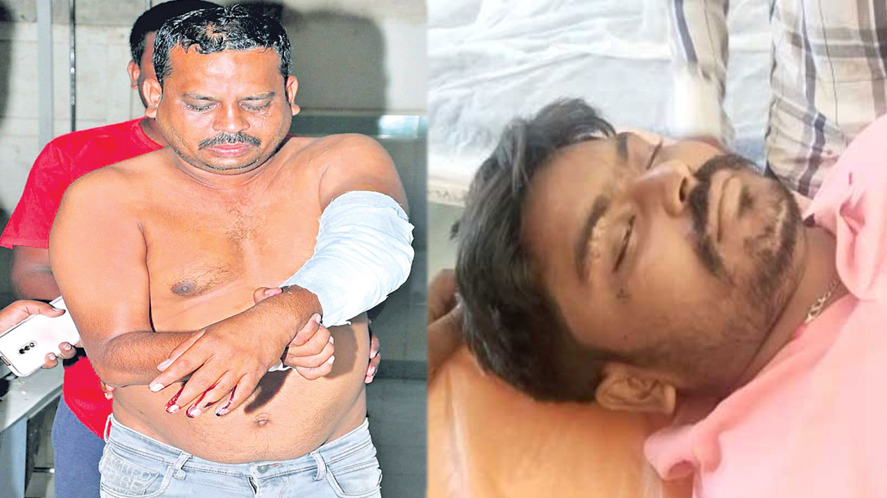 Pulivendula Firing: పులివెందుల కాల్పుల్లో గాయపడిన మస్తాన్‌కు చిత్తూరులో చికిత్స