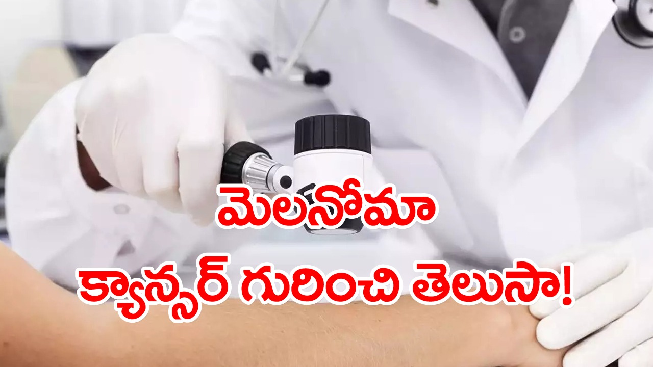 Metastatic melanoma: ఈ చర్మ క్యాన్సర్ గురించి తెలుసా? దీని గురించి పరిశోధనల్లో ఏం తేలిందంటే..!