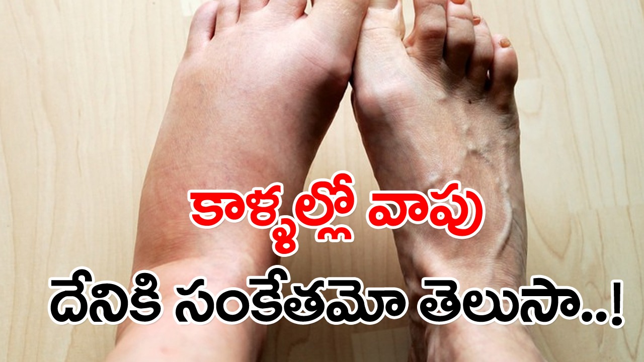 Unusual Swelling In Lower Legs: మోకాళ్ల కింద నుంచి అరికాలి లోపు కాళ్ల వాపులు కనిపిస్తున్నాయా..? ఆ వాపులు దేనికి సిగ్నలో తెలిస్తే..
