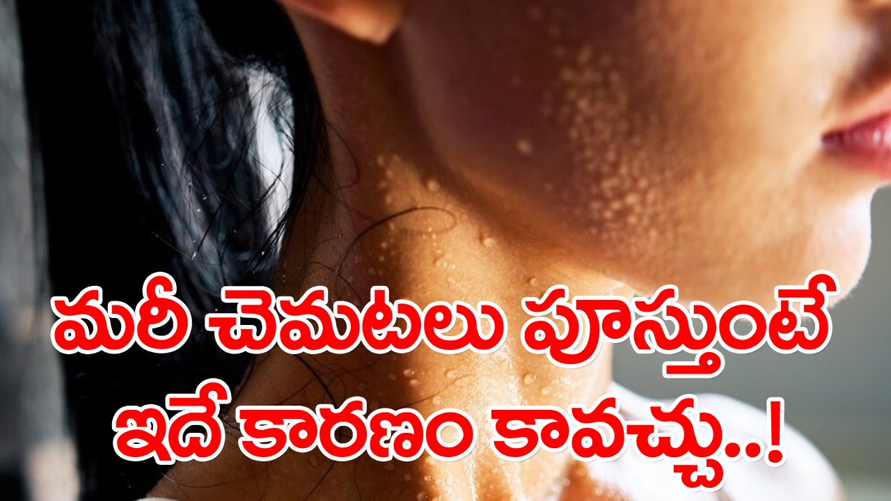 Too Much Sweat: వాతావరణం వేడిగా లేకపోయినా చెమటలు పడుతున్నాయా?.. అయితే మీరు ఈ ప్రమాదకర పరిస్థితితో బాధపడుతున్నారేమో!