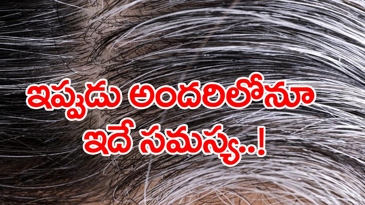 White Hair: 30 ఏళ్ల వయసు కూడా దాటకముందే తెల్లవెంట్రుకలా..? అసలు కారణాలేంటి..? ఈ వంటింటి చిట్కాలు వాడితే..!