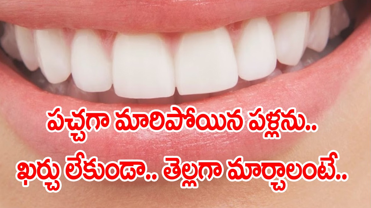 Teeth Whitening: పళ్లు గారబట్టి పచ్చగా మారిపోయాయా..? ఏ మందులూ అక్కర్లేదు.. ఇంట్లో దొరికే వీటితోనే తెల్లగా మార్చేయొచ్చు..!