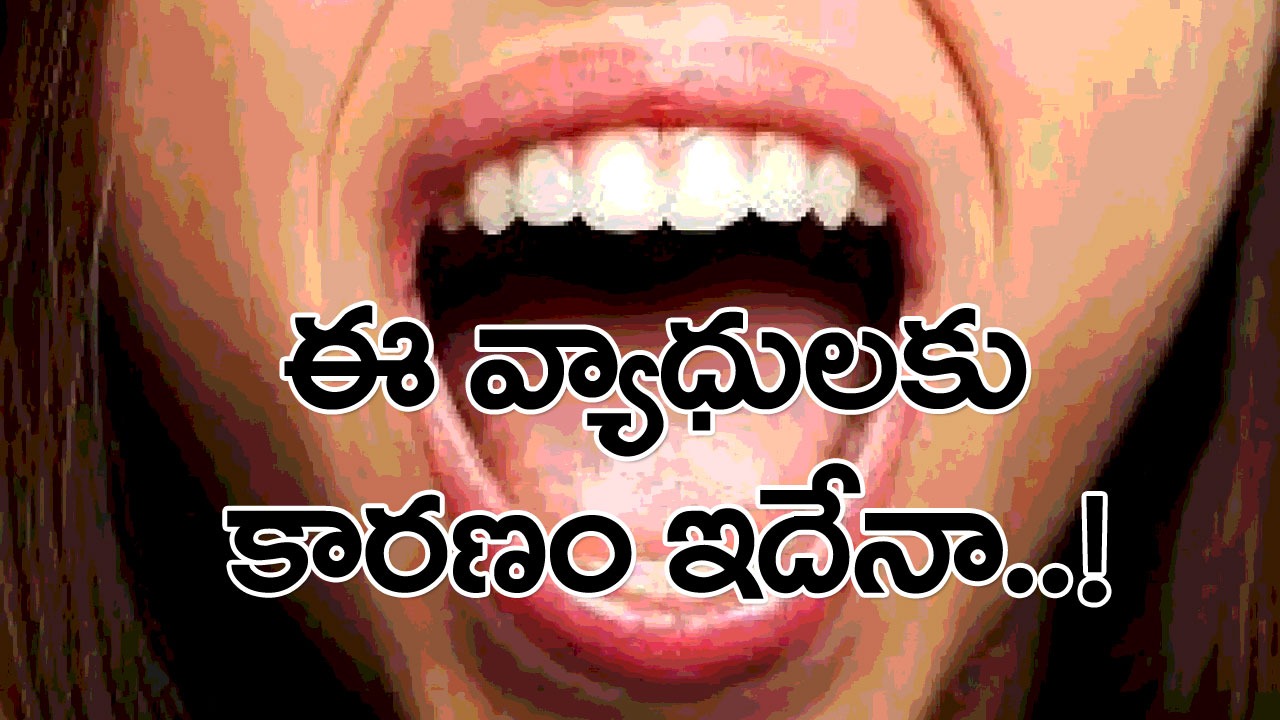 Health Tips: నోరు ఎప్పుడూ ఇలాగే ఉంటోందా..? అయితే ఈ 5 వ్యాధులే అసలు కారణం కావచ్చు..!