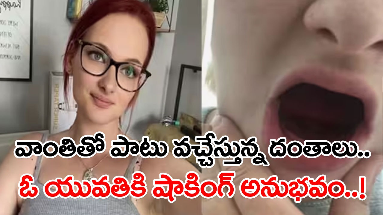 Teeth: అమ్మ బాబోయ్.. ఇదేంటి..? వాంతి చేసుకుంటోంటే ఈ యువతికి పళ్లన్నీ ఊడిపోవడమేంటి..? అసలేం జరిగిందంటే..!