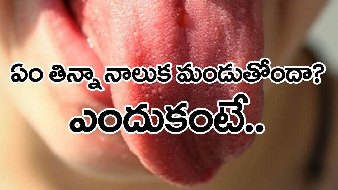Health Tips: నాలుక ఎర్రగా మారిపోయి ఏం తిన్నా మండుతోందా..? ఈ ఒక్క పని చేయండి చాలు.. 2 నిమిషాల్లో రిలీఫ్..!   
