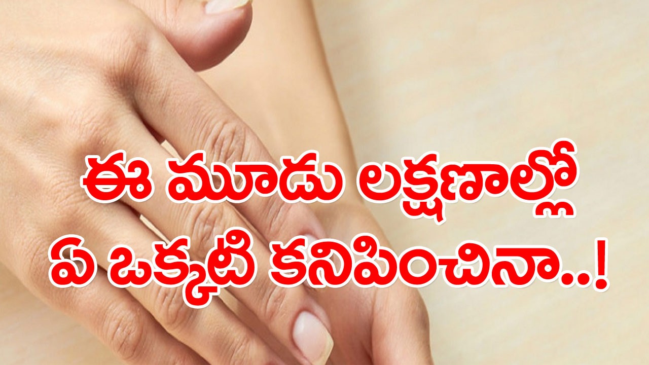 Health Tips: ఈ మూడు లక్షణాల్లో ఏ ఒక్కటి కనిపించినా.. శరీరంలో యూరిక్ యాసిడ్ పెరిగినట్టే లెక్క.. అదే జరిగితే..!