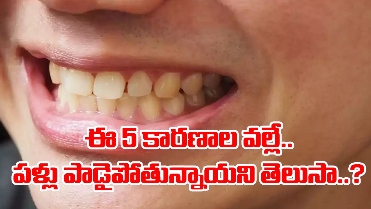 Teeth: తెలియక చేస్తున్న ఈ 5 బ్లండర్ మిస్టేక్స్ వల్లే.. దంతాలు పాడైపోతున్నాయ్.. మీరు కూడా ఇవే పొరపాట్లు చేస్తున్నారా..?