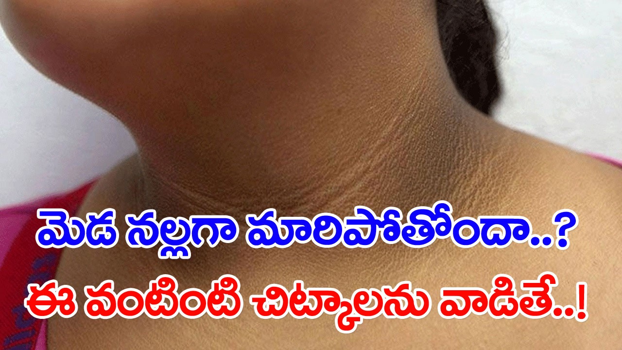 Dark Neck: మెడ నల్లగా మారిపోతోందా..? ఇంట్లో దొరికే వీటిని వాడండి చాలు.. మందులు వాడకుండానే బిగ్ రిలీఫ్..!