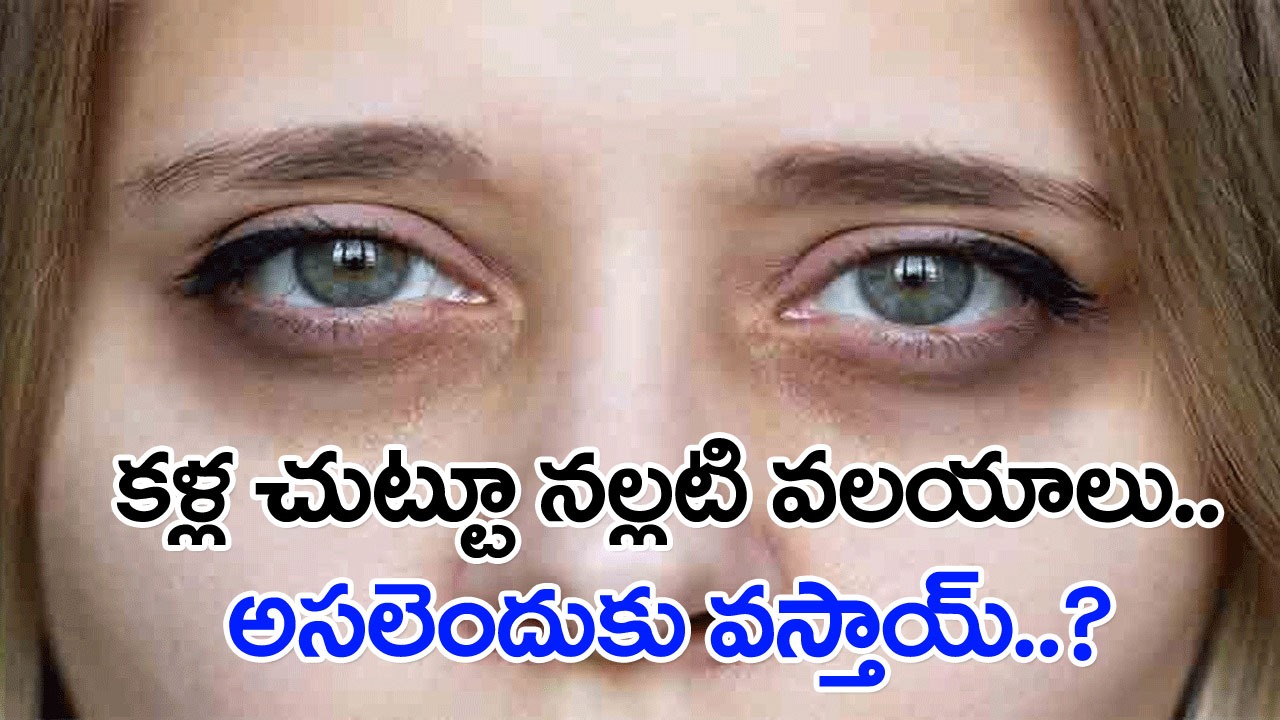 Dark Circles: కళ్ల చుట్టూ నల్లటి వలయాలు.. ఈ మూడు కారణాల్లో ఏదో ఒక దాని వల్లే అసలు సమస్య..! 