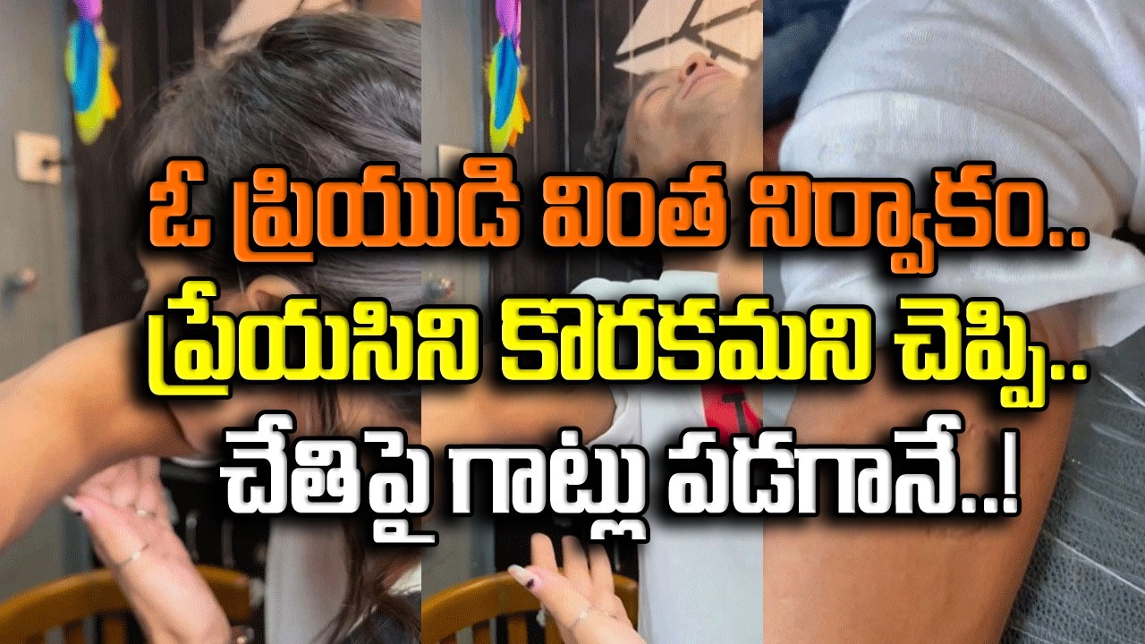 Viral Video: బాబోయ్.. ఇదేం పిచ్చి పని..? ప్రియుడి చేతిని కొరికిన ప్రేయసి.. గాట్లు పడిన తర్వాత అతడేం చేశాడో చూస్తే..!