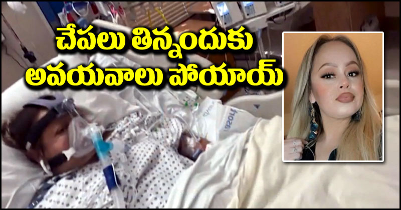 Tragic Incident: చేపలు తినింది.. నాలుగు అవయవాలు కోల్పోయింది.. ఇందుకు కారణం ఇదే!