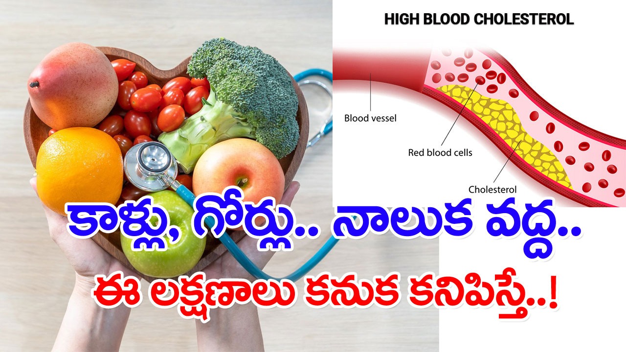 High Cholesterol Signs: ఏ టెస్టులూ చేయకుండానే.. శరీరంలో అధిక కొవ్వు ఉందని గుర్తించడం ఎలాగంటే..!