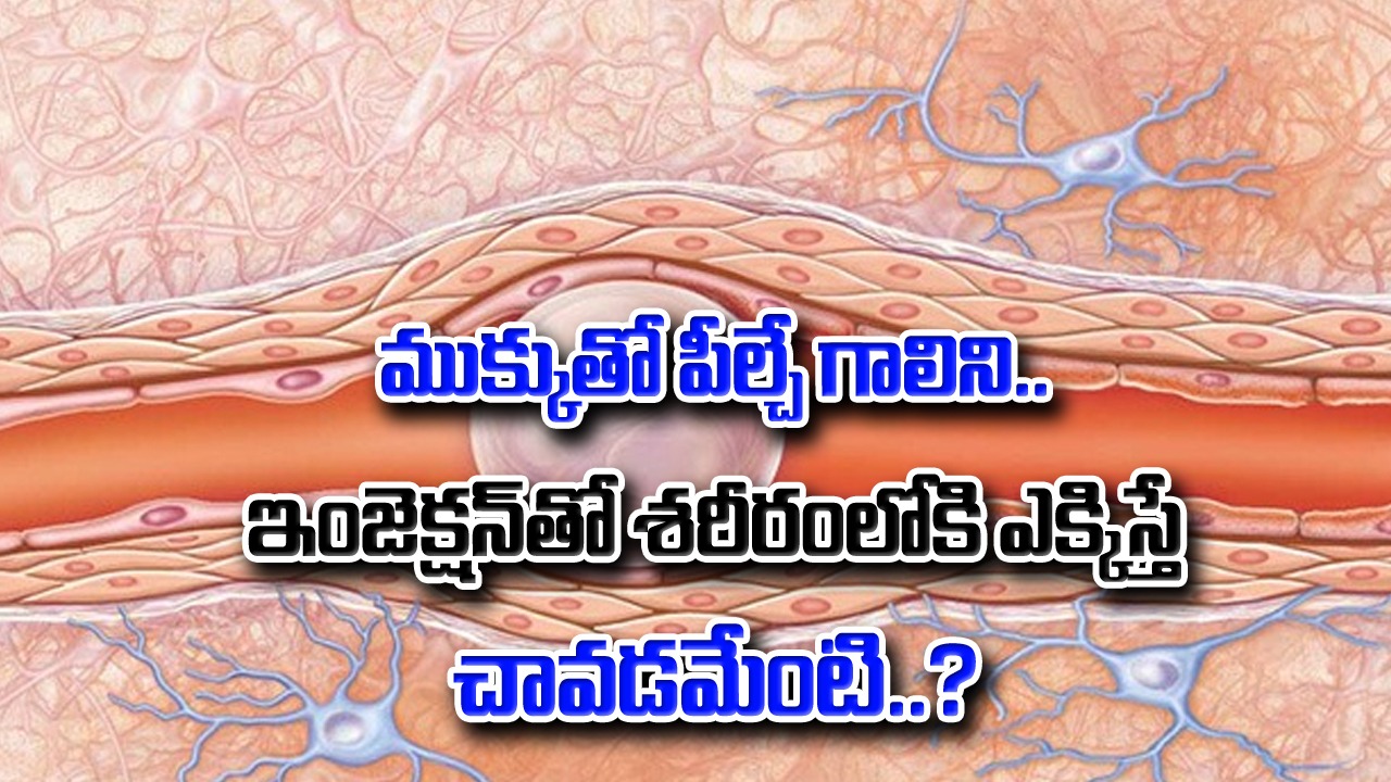 Air Embolism: అసలేంటీ ఎయిర్ ఎంబోలిజం..? ఇంజెక్షన్‌తో గాలిని శరీరంలోకి పంపిస్తే చచ్చిపోతారా..?