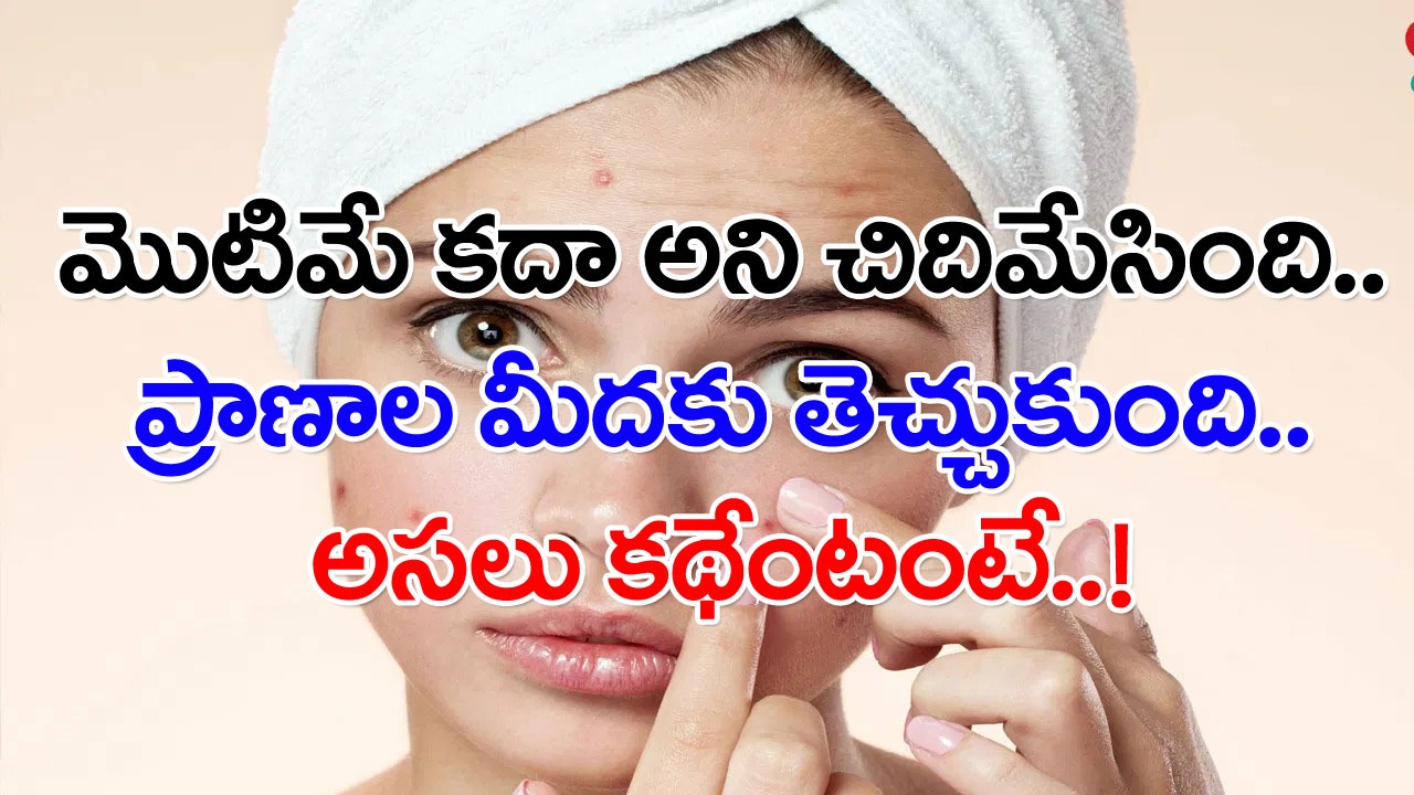 Woman: పెదవులకు దగ్గరగా ఓ మొటిమ.. చూడటానికి బాగాలేదని చిదిమేసిన మహిళ.. మర్నాడు నిద్రలేచిన తర్వాత చూస్తే..!