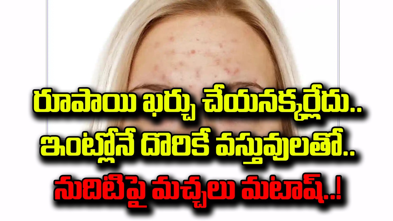 Skin Care: నుదిటిపై నల్లటి మచ్చలు ఏర్పడ్డాయా..? ఇంట్లోనే దొరికే వస్తువులతో వాటిని ఎలా తగ్గించొచ్చంటే..!