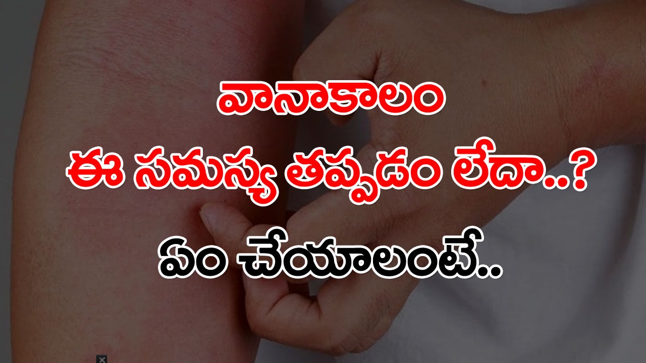 Allergy Prevention Tips: వర్షాకాలంలో అందరికీ ఇదే సమస్య.. అసలు అలెర్జీ రాకుండా ఉండాలంటే ఏం చేయాలంటే..!