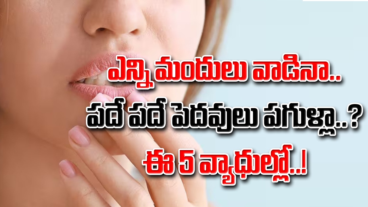 Cracked Lips: పెదవులు పదే పదే పగులుతున్నాయా..? ఈ 5 వ్యాధుల్లో ఏదో ఒకటి కారణం కావచ్చు..!