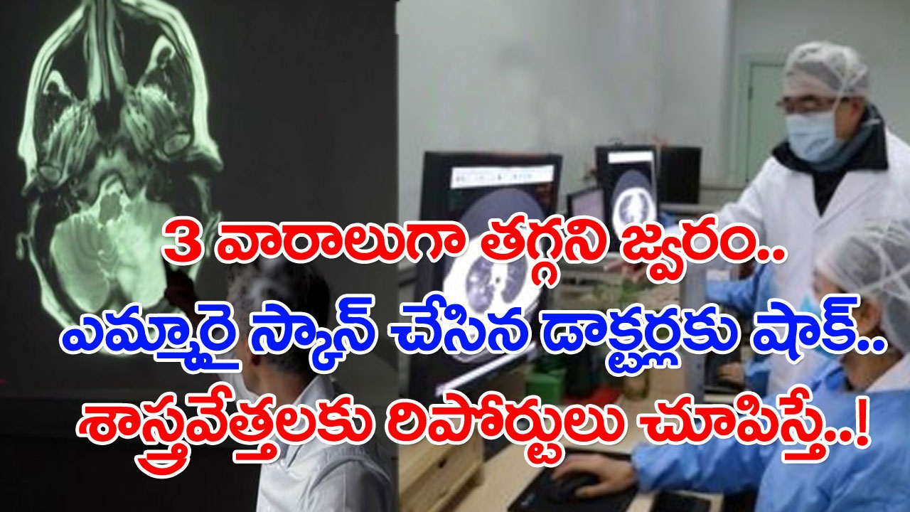 Woman: 3 వారాలుగా ఓ మహిళకు జ్వరం.. ఎమ్మారై స్కాన్ చేసిన డాక్టర్లకు షాక్.. ఏం చేయాలో తెలియక శాస్త్రవేత్తల వద్దకు వెళ్తే..!