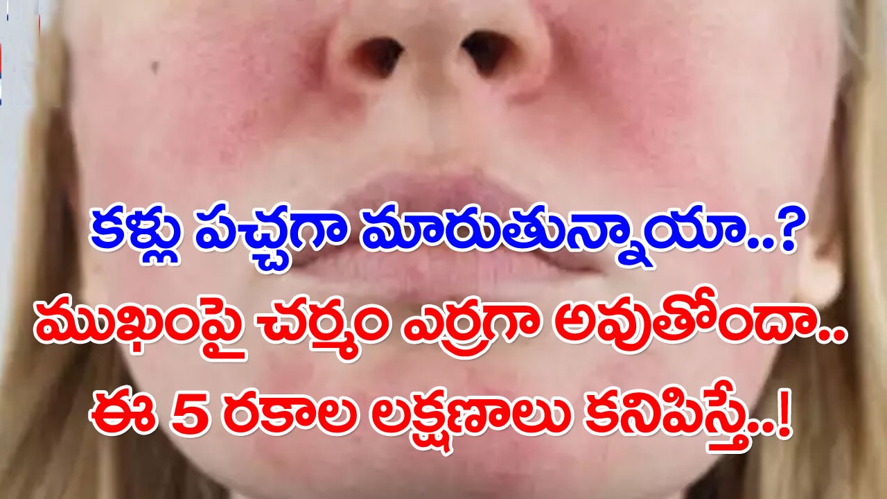 Liver Disease: ముఖంపై ఈ అయిదు రకాల లక్షణాలు కనిపిస్తే.. కాలేయ సమస్యలు ఉన్నట్టే లెక్క..!