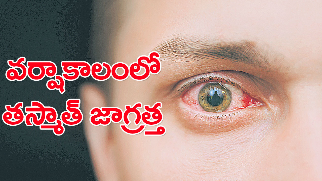 EYE: కండ్ల కలకతో తస్మాత్‌ జాగ్రత్త..! బారిన పడకుండా ఉండాలంటే..!