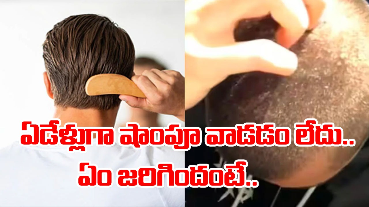 Health: తరచుగా షాంపూతో తలస్నానం చేస్తుంటారా? ఏడేళ్లుగా షాంపూ వాడని వ్యక్తి జట్టు ఎలా అయిందంటే.. 