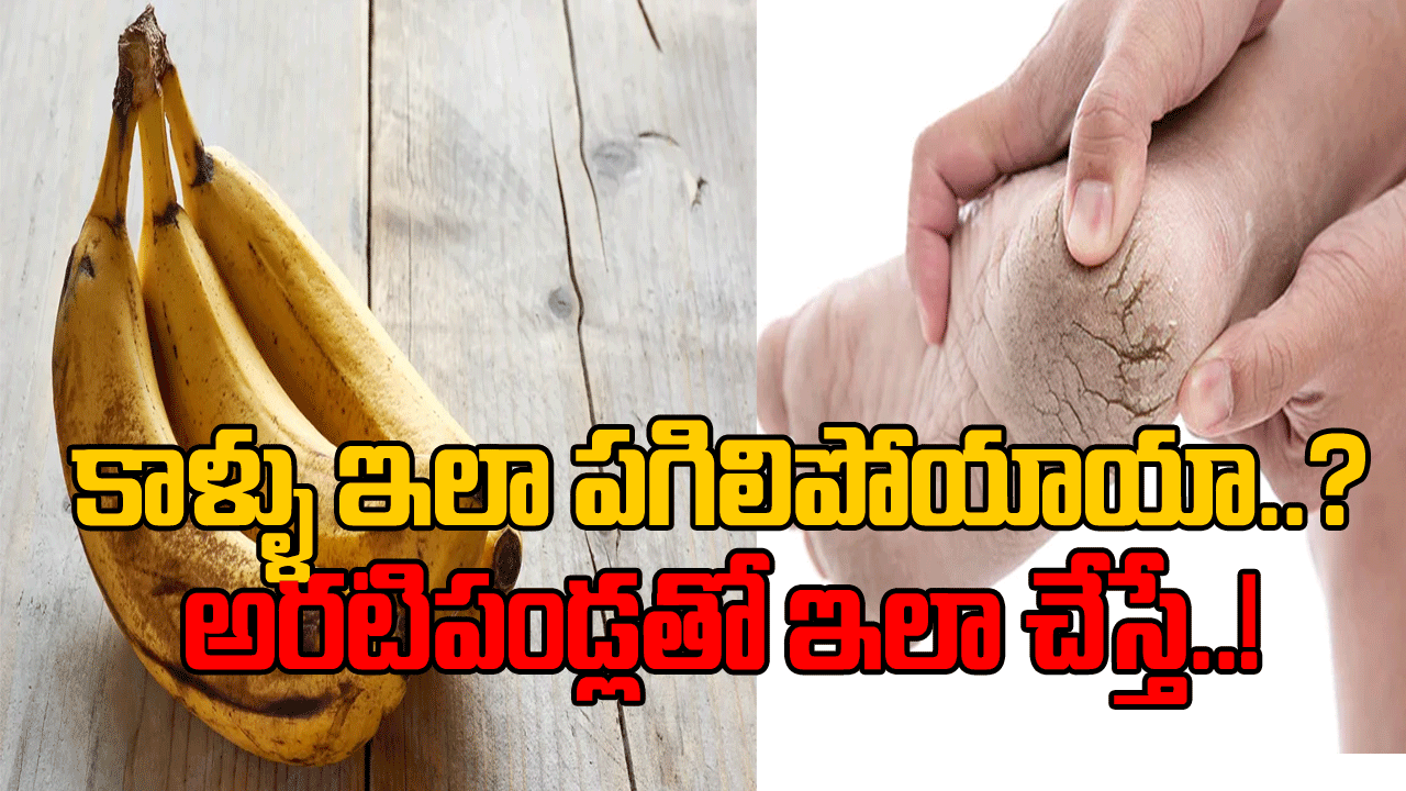 Health Tips: చలికాలంలో వచ్చే సమస్యే ఇది.. అరటిపండ్లతో ఇలా చేయండి చాలు.. కాళ్లకు పగుళ్లు ఉంటే మటాష్..!