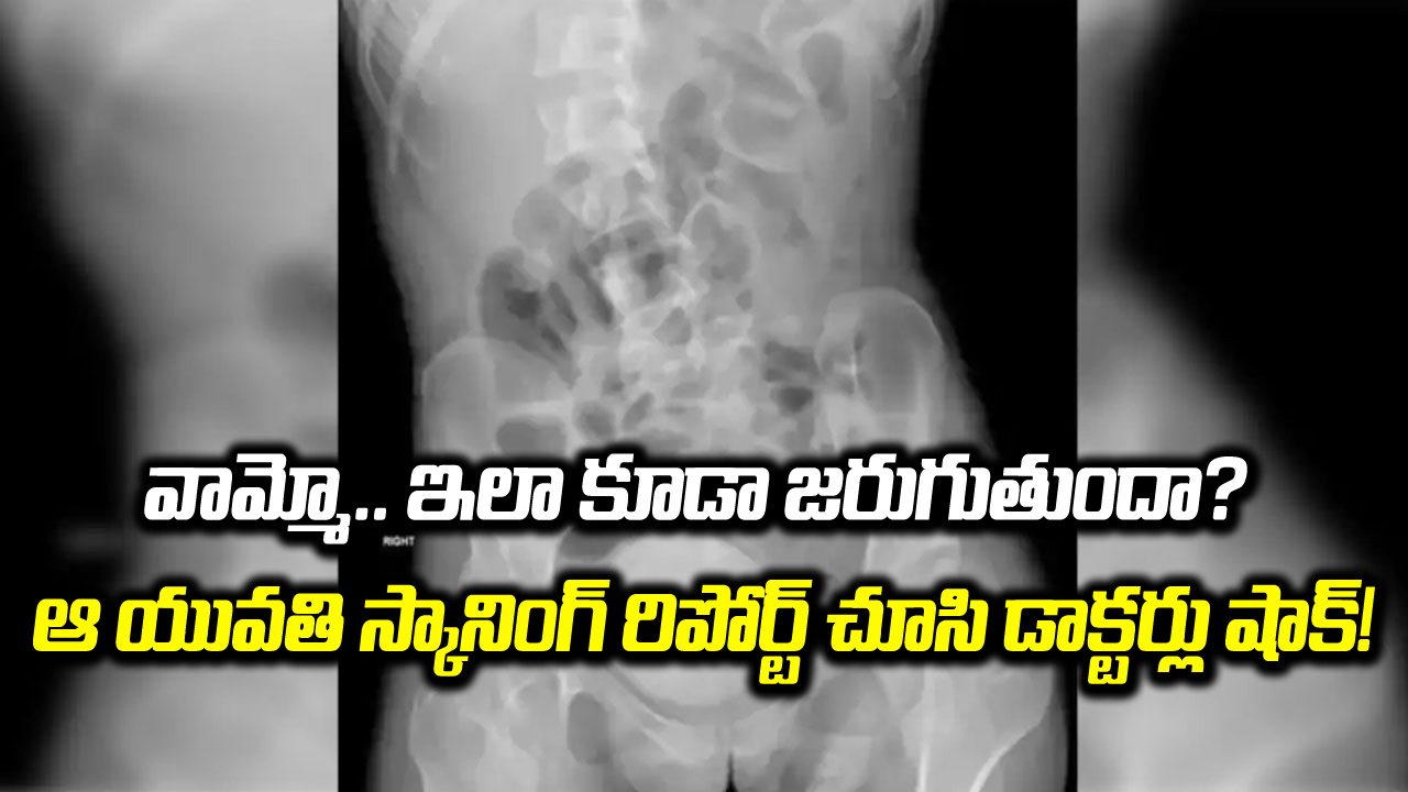 Viral: విపరీతమైన కడుపునొప్పితో వచ్చిన 27 ఏళ్ల యువతి.. వింత వింత లక్షణాలు విని డాక్టర్లకు డౌట్.. స్కాన్ చేసి చూస్తే..!