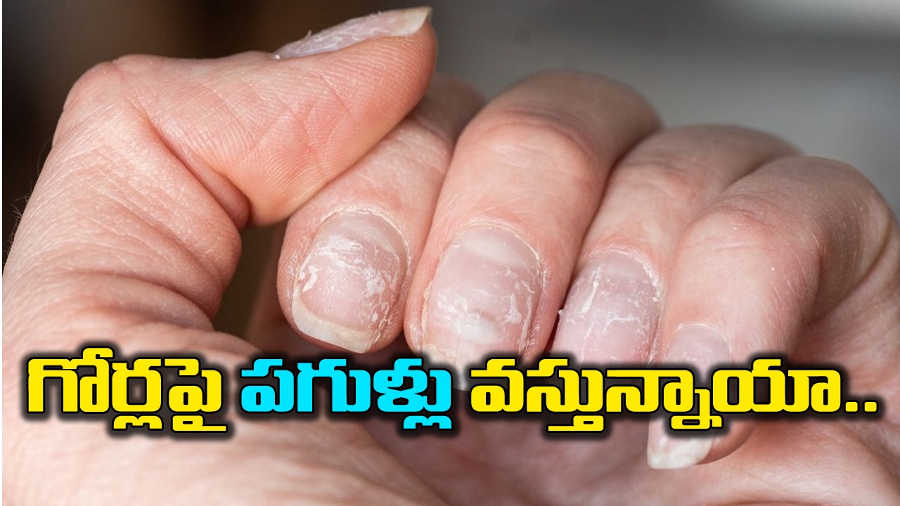  Nails: గోర్లపై పగుళ్లు వస్తున్నాయా..? వాటంతట అవే విరిగిపోతున్నాయా..? ఈ 5 విషయాలు తెలుసుకోవాల్సిందే..!