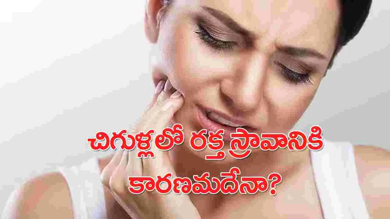 Bleeding Gums: చిగుళ్ల నుంచి రక్తం కారడం ప్రమాదానికి సంకేతమా? తప్పక తెలుసుకోండి..!