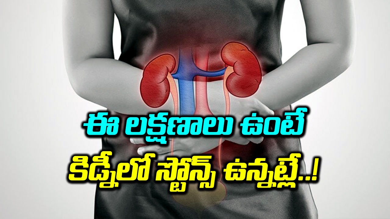 Kidney Stones: కిడ్నీ స్టోన్స్ లక్షణాలు, వాటిని గుర్తించే ఐదు సంకేతాలు ఇవే...!