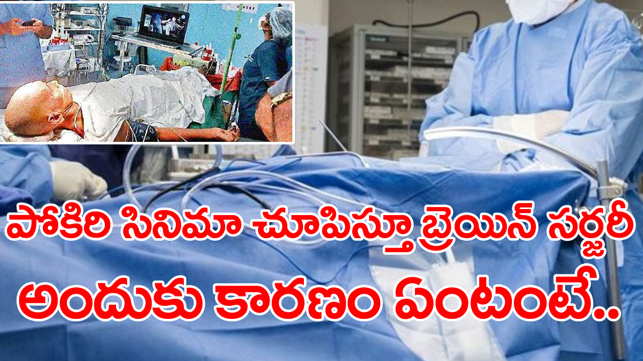 AP News: మహేశ్ బాబు ఫ్యాన్‌కి ‘పోకిరి’ సినిమా చూపిస్తూ బ్రెయిన్‌ సర్జరీ.. ఇలా ఎందుకు చేశారంటే..