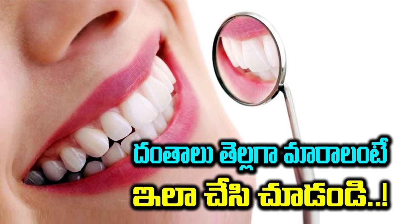 Teeth Health : దంతాలను సహజంగా తెల్లగా చేసుకోవడం ఎలా..!