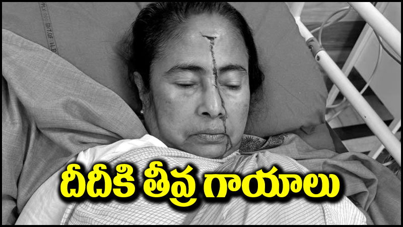 Mamata Banerjee: మమతా బెనర్జీకి తీవ్ర గాయాలు.. ఆసుపత్రికి తరలింపు