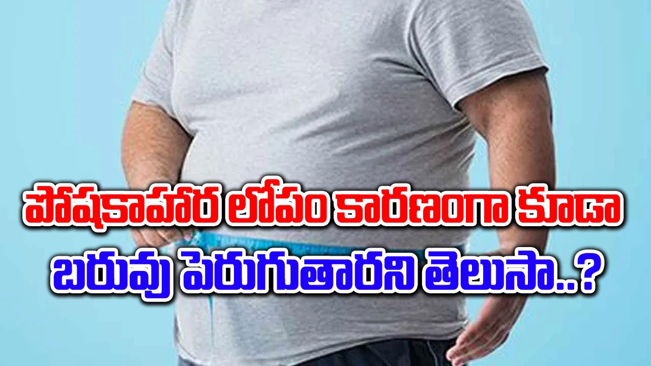 Nutritional Deficiency : పోషకాహార లోపాల కారణంగానే బరువు ఇట్టే పెరుగుతారు. ఇలా ఎందుకంటే..!!