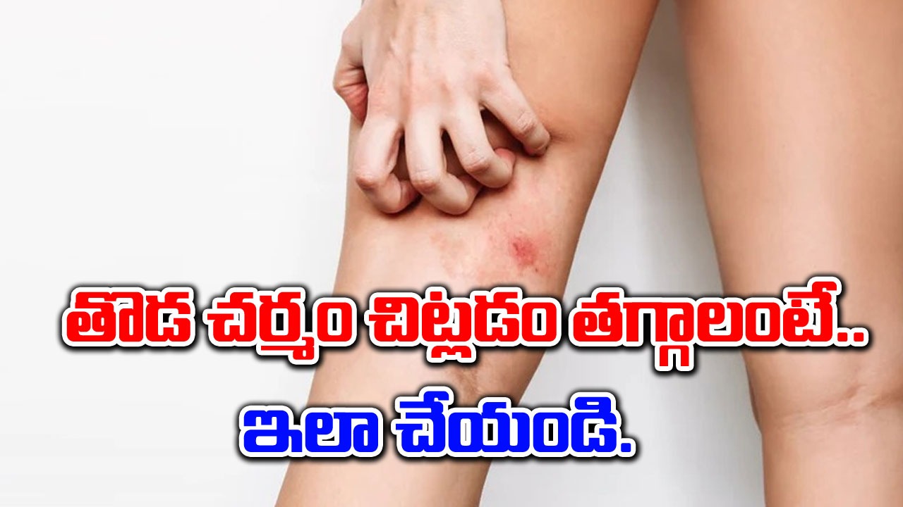 Skin Chafing : తొడ చర్మం పగుళ్లను తగ్గించాలంటే ఈ ఆరు టిప్స్ ట్రై చేయండి.. సరిపోతుంది..!