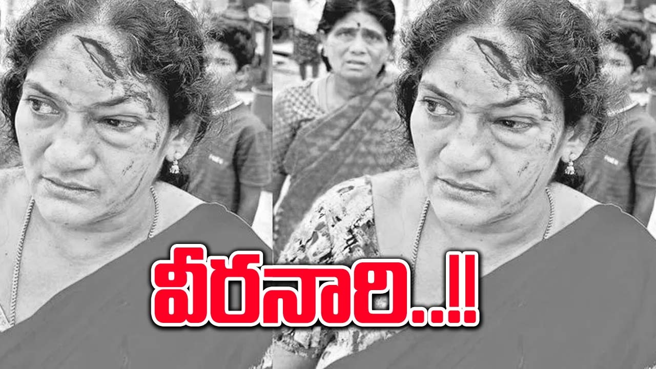  AP Elections: నుదిటిపై గాయం.. రక్తమోడుతోన్నా బెదరని ఏజెంట్