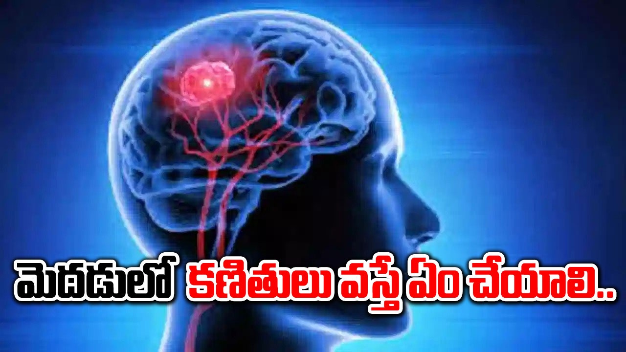 Brain Tumor: మెదడులో కణితులు ఉన్నట్లయితే ఈ లక్షణాలు, సంకేతాలు ఎలా ఉంటాయి..!!