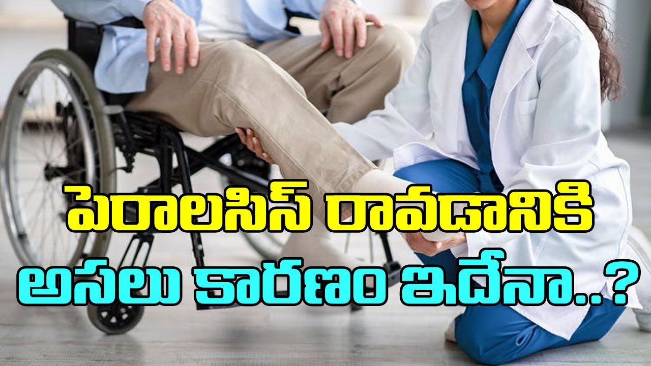 Paralysis: పెరాలసిస్ రావడానికి అసలు కారణం ఇదా? వైద్యులు తేల్చిన నిజాలివీ..!