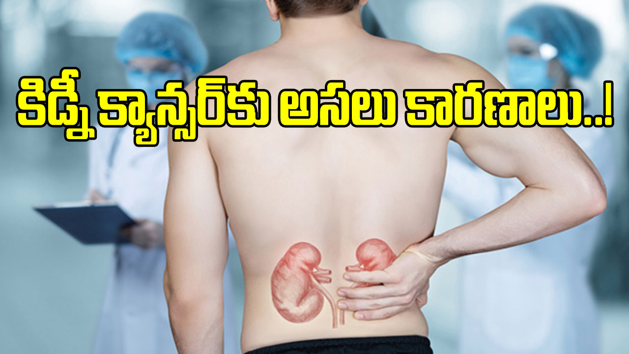 Kidney Cancer:  ఈ తప్పులు చేయడం వల్ల కిడ్నీ క్యాన్సర్ వస్తుందట.. ఇంతకీ అవేంటంటే..!