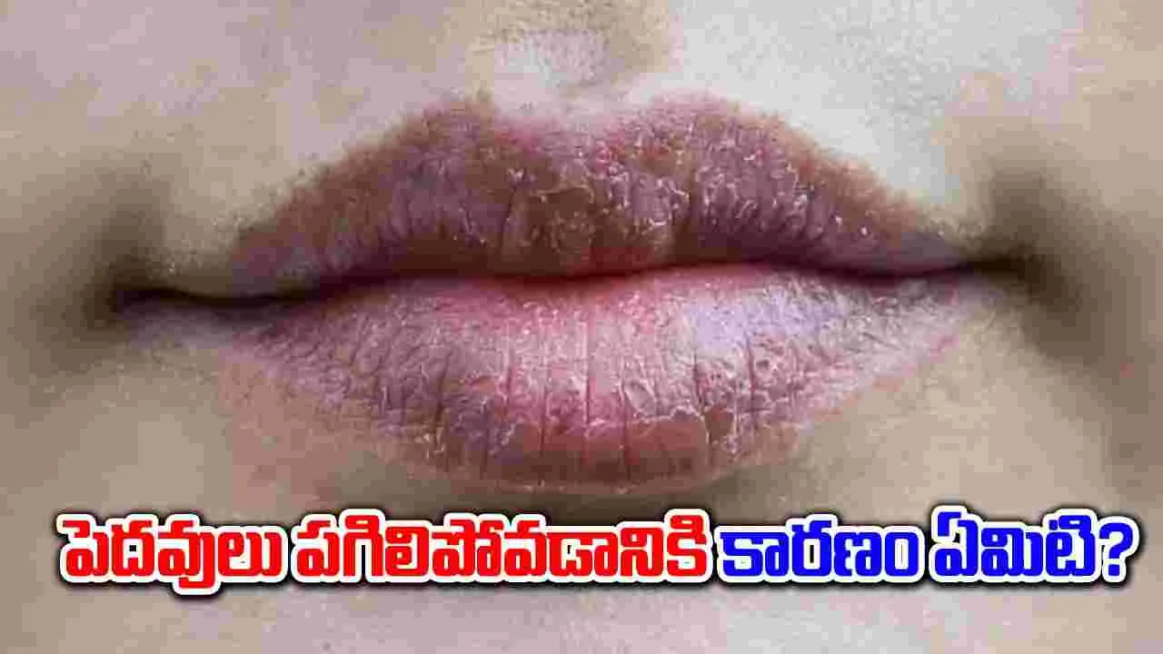 Chapped Lips : పెదవులు పగిలిపోవడానికి కారణం ఏంటో తెలుసా..! 