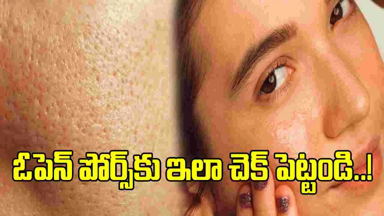 Open Pores:  ఓపెన్ పోర్స్ కు సూపర్ ట్రీట్మెంట్.. ఈ టిప్స్ ట్రై చేయండి..!