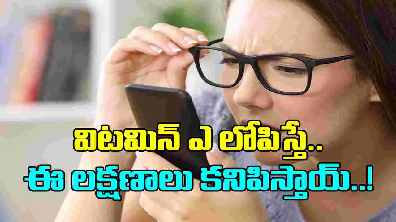 Vitamin-A: విటమిన్-ఎ లోపిస్తే ఈ లక్షణాలు కనిపిస్తాయి..  ఓసారి చెక్ చేసుకోండి..!